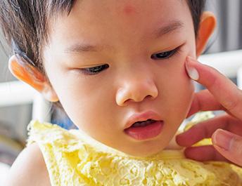 care for atopic-prone skin mini - Baby Child